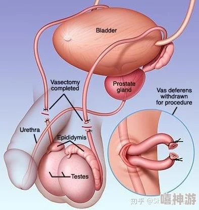 阴蒂环为何受女性青睐？是情趣提升还是健康风险？